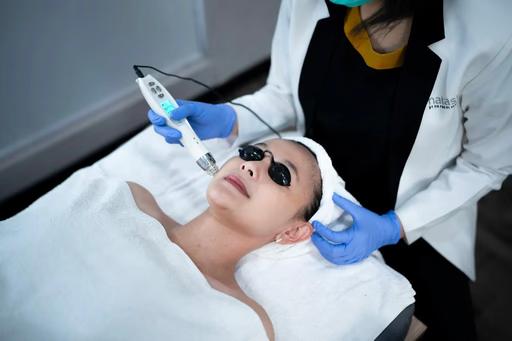 Laser Dual Yellow for Melasma